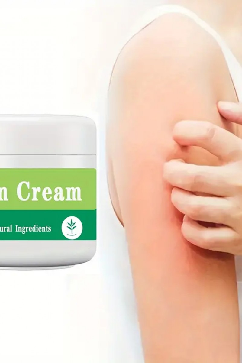 Psoriasis-Cream